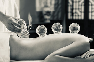 Shiatsu Den Pic 3 - Cupping used for tired sore muscles and aid in good health