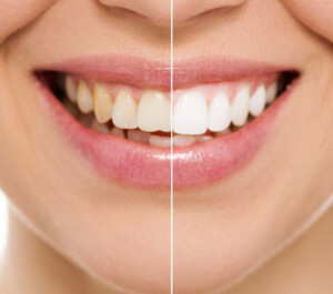 Lumina Dental Pic 4