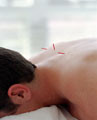 Haberfield Naturopathic Centre Pic 1 - acupuncture services