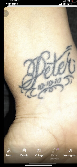 ReNude Laser Tattoo Removal Gold Coast Pic 1 - Peter Sorry to say but its time to go