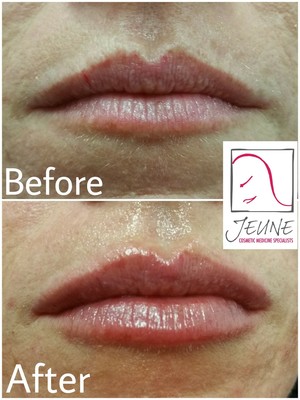 Jeune Cosmetic Medicine Pic 4