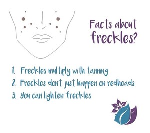 Refresh Face and Skin Rejuvenation Pic 4 - I think freckles are cute If you arent so crazy about yours come see me