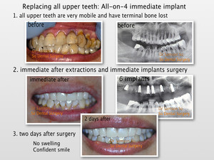 So Dental Chatswood Pic 4