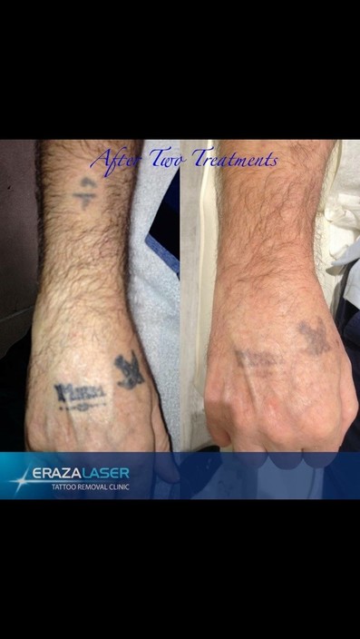 Eraza Laser Clinic Pic 1