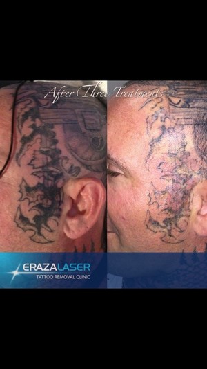 Eraza Laser Clinic Pic 3