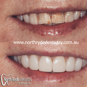 North Ryde Dentistry Pic 5