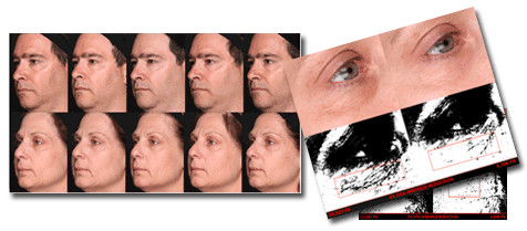 DermaStem TM Pic 1 - Clinical results