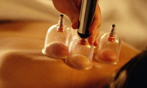 Primal Remedies Pic 2 - Myofascial Cupping