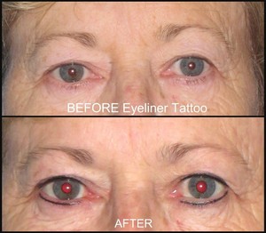 Eye Secrets Sydney Pic 4 - Eyeliner Tattoo Before Immediately After