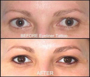 Eye Secrets Sydney Pic 2 - Eyeliner Tattoo Before Immediately After