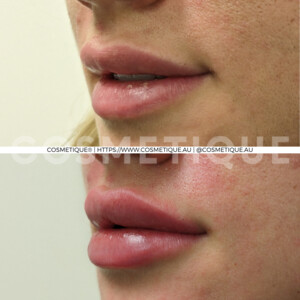 Cosmetique Midland - Cosmetic & Laser Clinic Pic 2