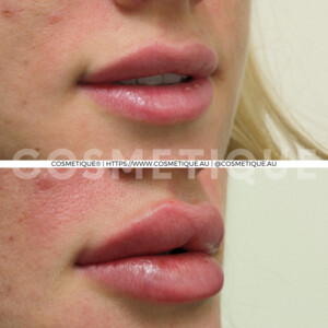 Cosmetique Midland - Cosmetic & Laser Clinic Pic 3