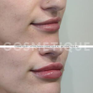 Cosmetique Midland - Cosmetic & Laser Clinic Pic 4