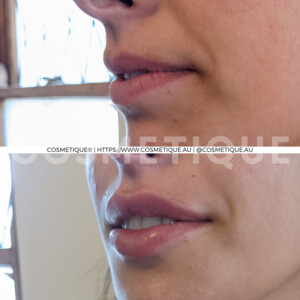 Cosmetique Midland - Cosmetic & Laser Clinic Pic 5