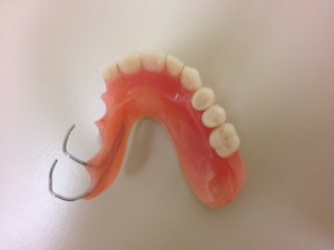 Denture Creations Pic 3 - Partial acrylic denture