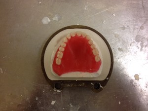 Denture Creations Pic 4 - Processing a full upper denture