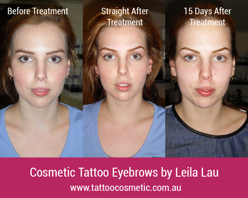 Cosmetic Tattoo Clinic Pic 1 - Eyebrow Feathering Sunshine Coast