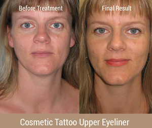 Cosmetic Tattoo Clinic Pic 3 - Eyeliner Tattoo Sunshine Coast