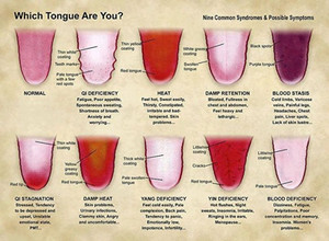 Maleny Acupuncture Pic 5 - Tongue Diagnosis