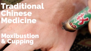 Zenith Holistic Healing Pic 3 - Traditional moxibustion and cupping techniques revitalise and stabilise so clients return to homoeostasis