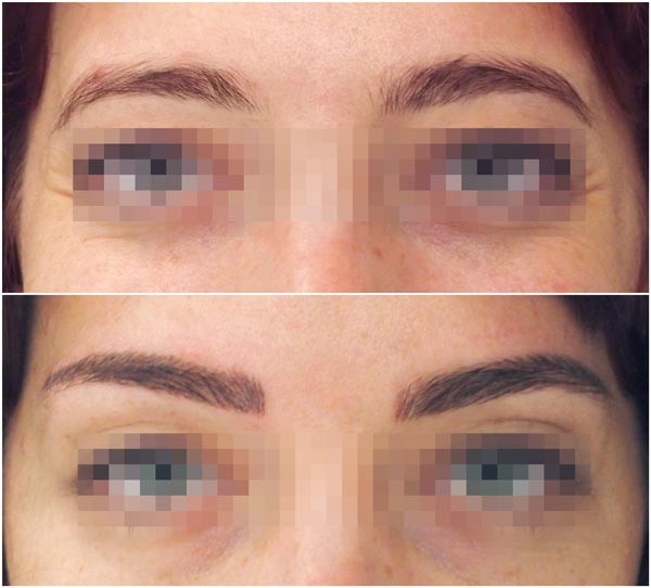 The Art of Eyebrows Pic 1 - Before and after eyebrow design