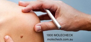 Mole Check Clinic Pic 2