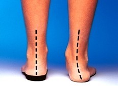 ULTIMATE PODIATRY Pic 4