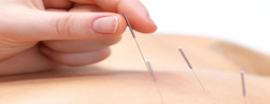 Lockridge Physiotherapy Pic 2 - Dry needling