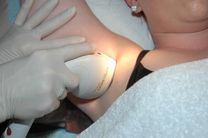 Cosmetic Elegance Clinic Pic 5 - Laser hair removal