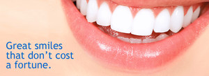 The Dental Gallery Mount Lawley Pic 4 - Great smiles that dont cost a fortune