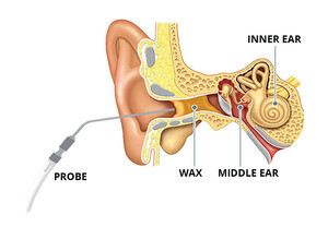 The Hearing Specialist Pic 2 - The Hearing Specialist Mount Eliza Ear Wax Removal