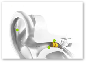 The Hearing Specialist Pic 3 - The Hearing Specialist Mount Eliza Lyric