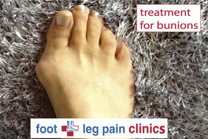 Foot + Leg Pain Clinics Pic 2 - Bunion Treatment