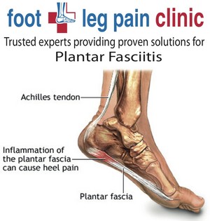 Foot + Leg Pain Clinics Pic 5 - Plantar Fasciitis Heel Pain Treatments