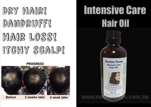 No More Lice Australia Pic 3 - Hair care regrowth