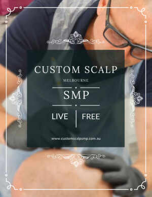 Custom Scalp SMP Scalp Micro Pigmentation Melbourne Pic 5 - Transform confidence with Custom Scalp SMP Melbourne Our Scalp Micropigmentation artistry inspired by Melbournes style ensures precision