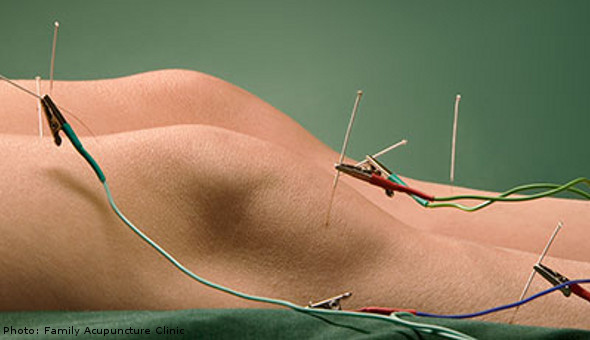 Ipswich Acupuncture Practice Pic 1