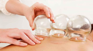 Holistic Chinese Massage Therapy Pic 4 - Traditional Chinese Cupping Acupuncture