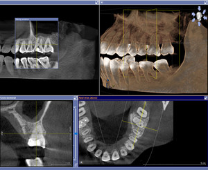 Chermside Dental Care Pic 4 - 3D Xray Examination of your teeth at Chermside Dental Care