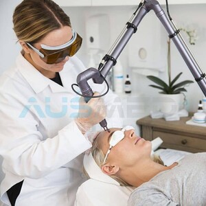 Skin Shine Laser Treatment Pic 5 - CO2 Fractional Laser Skin Resurfacing acne scars wrinkles fine lines skin renewal