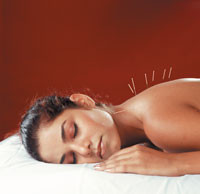 Zen Health Pic 2 - acupuncture