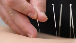 Silky Oak Chiropractic Pic 2 - Silky Oak Chiropractic Dry Needling Carindale