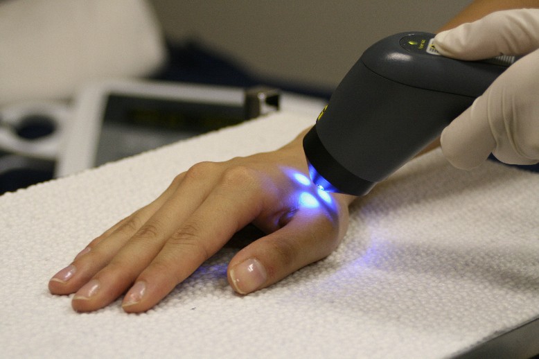 Rejuvenate Health Center Pic 1 - laser acupuncture