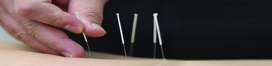 Cloud 9 Massage Pic 1 - Dry needling Western Accupuncture