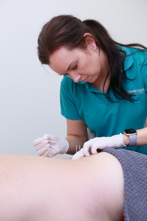 Advantage Healthcare & Physiotherapy Pic 4 - Acupuncture dry needling