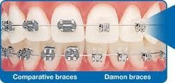 Sydney Dental Clinic Bankstown Pic 3 - Demon Braces