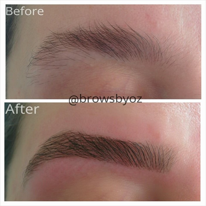 Brows and Aesthetics Pic 1