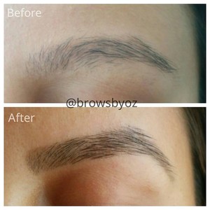 Brows and Aesthetics Pic 3