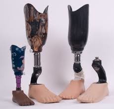 OAPL Health & Mobility Centre Pic 1 - Prosthetics