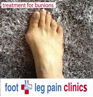 Foot + Leg Pain Clinic - Werribee Pic 5 - bunion treatment